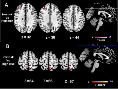 Impacts of AD-Related ABCA7 and CLU Variants on Default Mode Network Connectivity in Healthy Middle-Age Adults